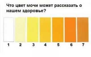 Тёмная моча при беременности