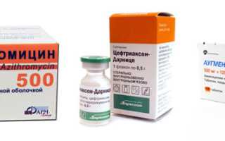 Что нужно и чего нельзя делать при гайморите