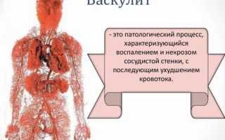 Опасные проявления и лечение геморрагического васкулита у детей (болезни Шенлейна-Геноха)