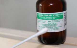 Подсушиваем прыщи на лице в домашних условиях