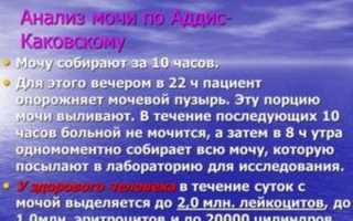 Анализ мочи по Аддис Каковскому