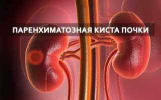 Паренхиматозная киста почки