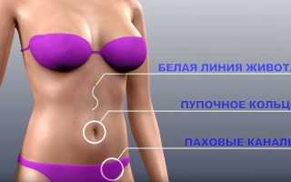 Классификация грыж по типу образования и приобретения