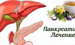 Как лечить панкреатит: различные методы
