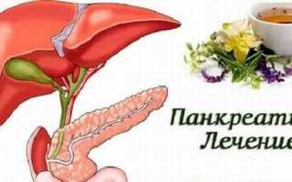 Как лечить панкреатит: различные методы