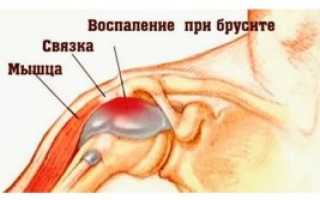 Здоровые суставы – профилактика и лечение