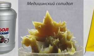 Лечение псориаза солидоловыми мазями