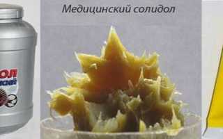 Лечение псориаза солидоловыми мазями