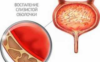 Пшено при цистите