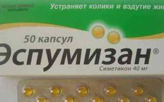 Чем можно заменить Эспумизан: более дешевые аналоги препарата