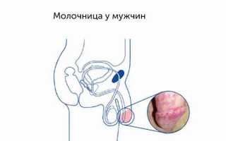 Лечение и профилактика грибковых заболеваний полового члена