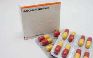 Амоксициллин при цистите