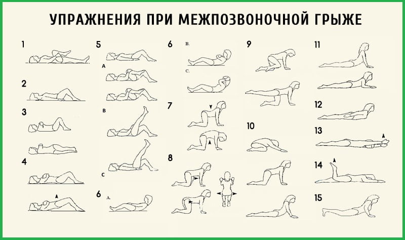 Комплекс упражнений при грыже позвоночника поясничного отдела.