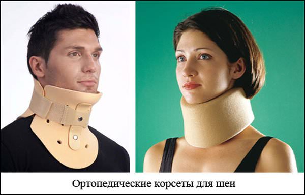 Корсеты при грыже шеи на мужчине и женщине.