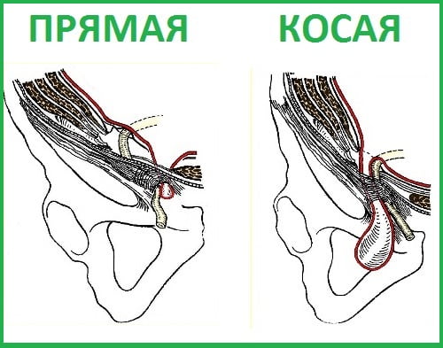Сравнительный рисунок.