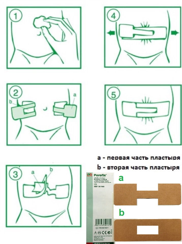 Инструкция в картинках для пластыря Порофикс.