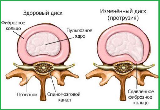 Рисунок показывающих динамику патологии