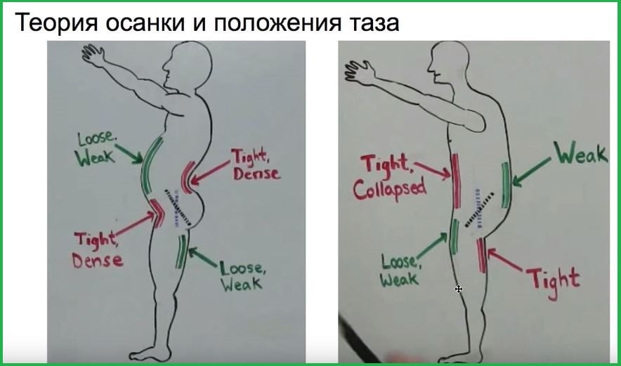 Теория осанки и положение таза.