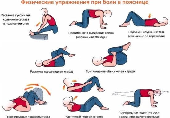 Физические упражнения при грыже в пояснице.