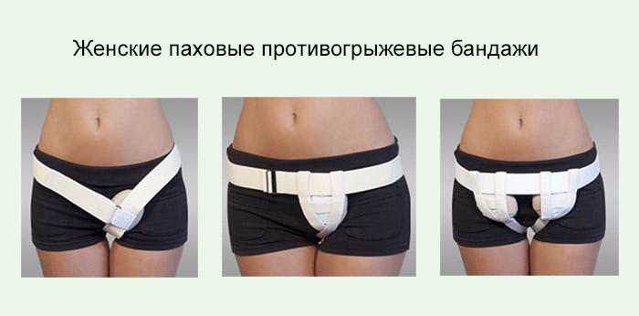 женские паховые противогрыжевые
