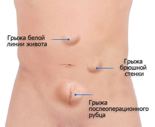 Три варианта патологии
