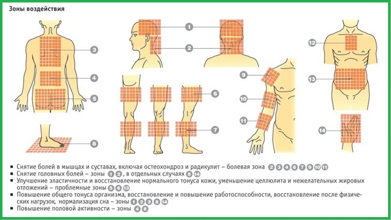Зоны воздействия аппликатора.