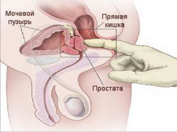 Массаж простаты 