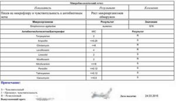 Посев мочи на стерильность