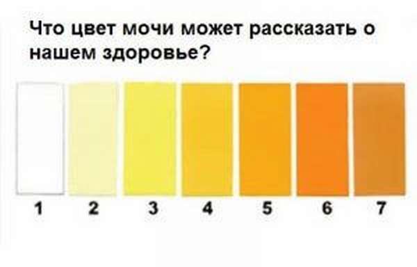 цвет мочи
