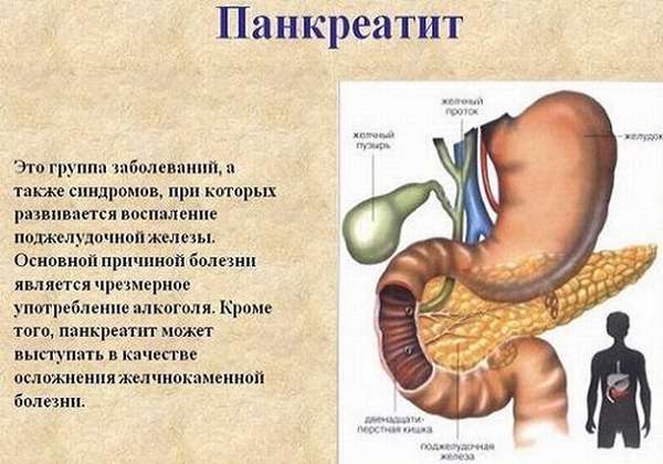 определение панкреатита