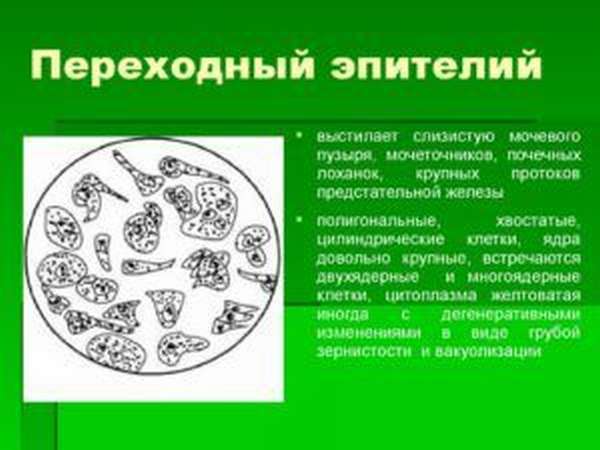 Плоский эпителий в моче