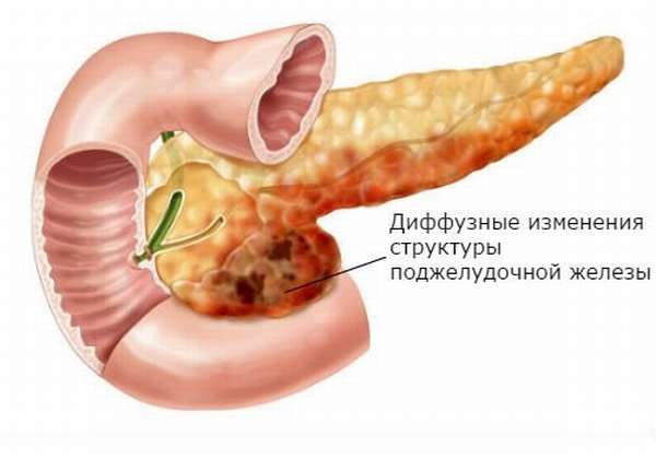 ДИПЖ