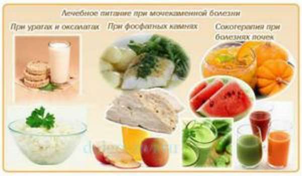 Как вывести камень из мочеточника