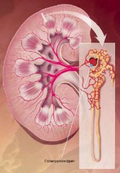 гломерулонефрит