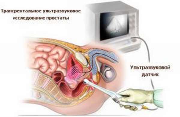 УЗИ простаты