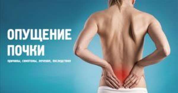 Опущение почки