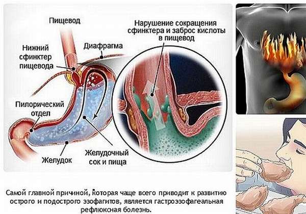 Картинка 4