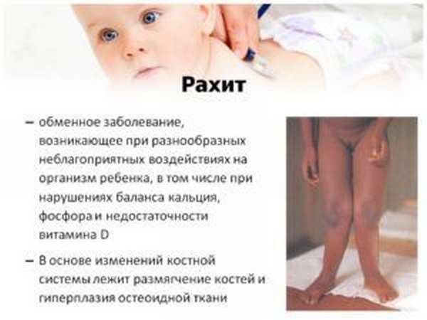 Фосфаты в моче у ребенка