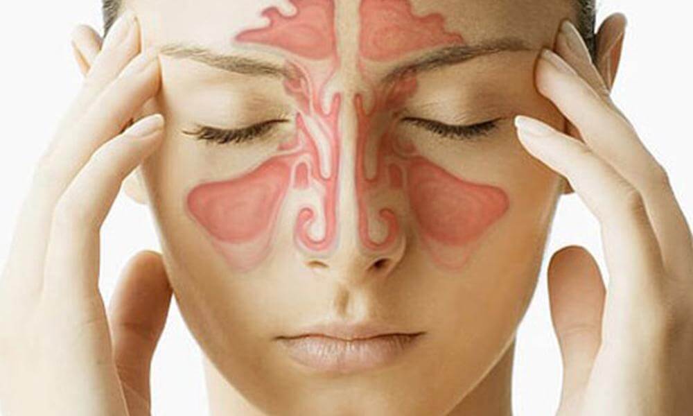 болит голова синусит