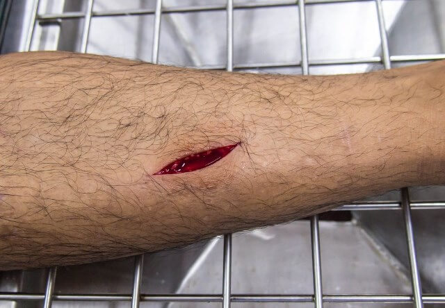 тысячелистник масло