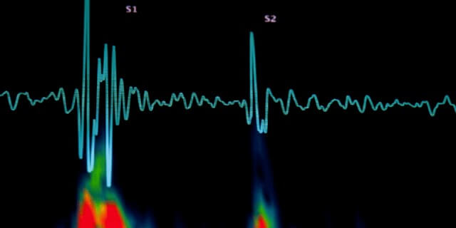 горькая тыква